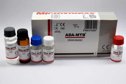 ADA-MTB - Determination of Adenosine Deaminase Activity in serum, Plasma and Biological Fluids